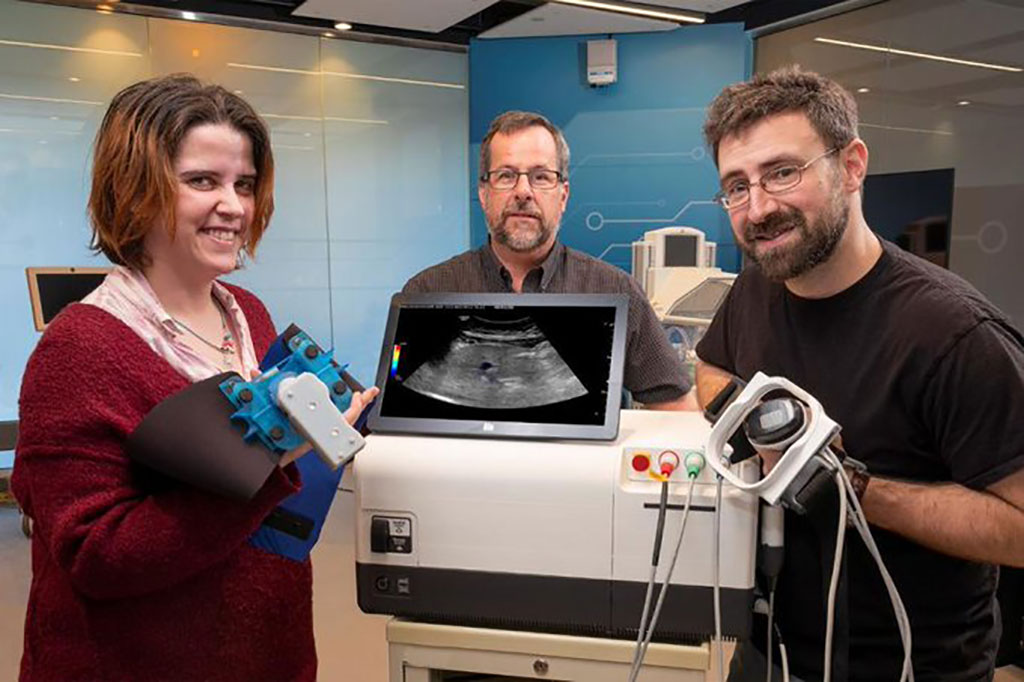 Imagen: El ultrasonido podría cambiar las reglas del juego en el futuro para controlar la diabetes (Fotografía cortesía de General Electric)