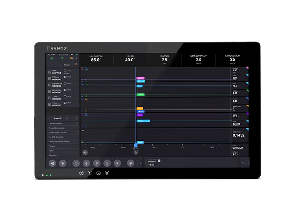 Imagen: Essenz Patient Monitor es un innovador sistema de gestión de datos de perfusión (Fotografía cortesía de LivaNova)