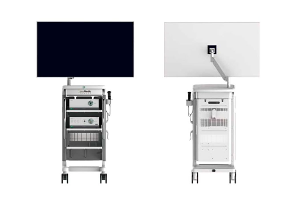 Imagen: Sistema de imágenes endoscópicas de luz blanca Optomedic 104K Ultra HD utiliza tecnología avanzada para ayudar a los cirujanos (Fotografía cortesía de Optomedic)