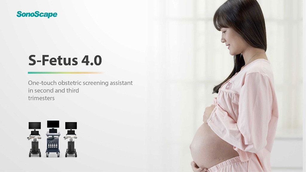 Imagen: Asistente de Evaluación Obstétrica de Sonoscape S-FETUS 4.0  (Fotografía cortesía de Sonoscape Medical)