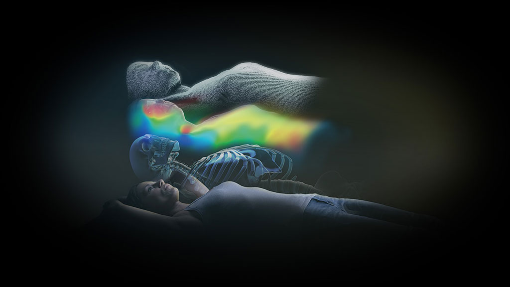 Imagen: ExaCtrac Dynamic con marca con CE y aprobada por la FDA permite el suministro de radioterapia de precisión (Fotografía cortesía de BrainLab) Imagen: ExaCtrac Dynamic con marca con CE y aprobada por la FDA permite el suministro de radioterapia de precisión (Fotografía cortesía de BrainLab)