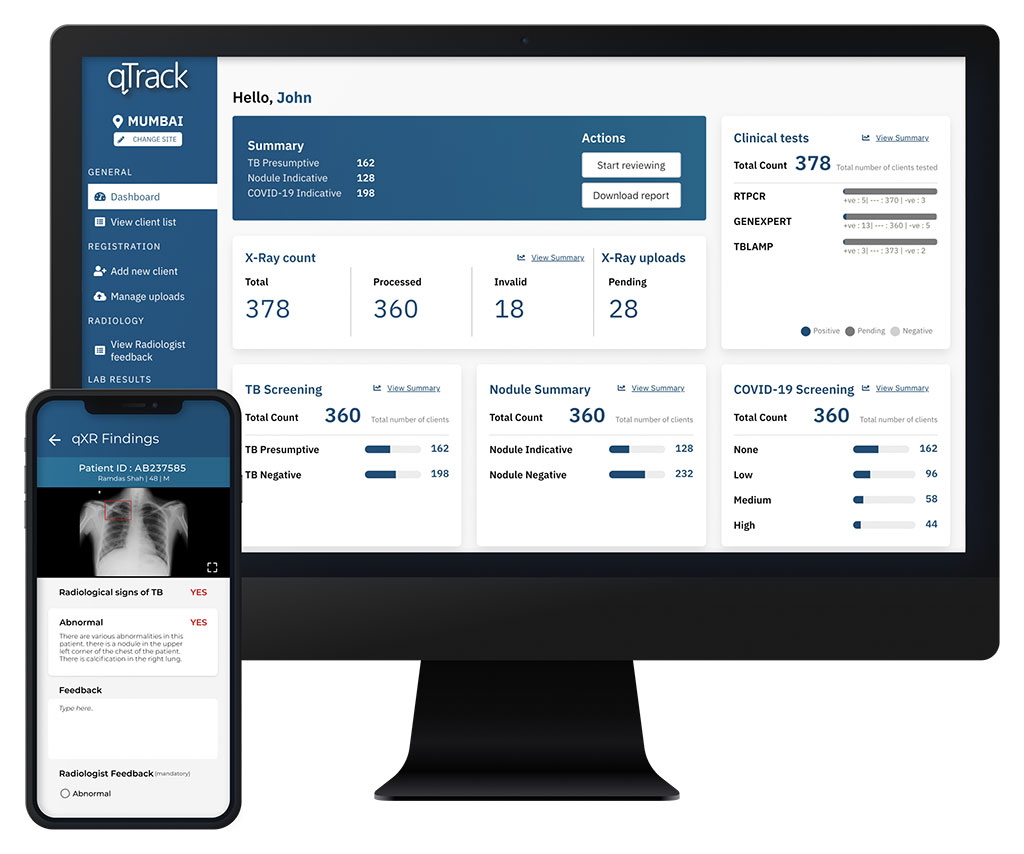 Imagen: qTrack es una plataforma de gestión de salud pulmonar completa (Fotografía cortesía de Qure AI) Imagen: qTrack es una plataforma de gestión de salud pulmonar completa (Fotografía cortesía de Qure AI)