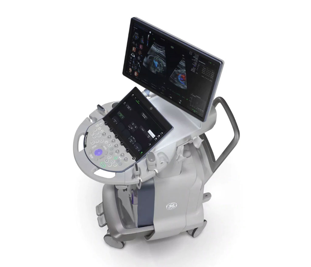 Imagen: El Voluson Expert 2 de próxima generación (Fotografía cortesía de GE Healthcare) Imagen: El Voluson Expert 2 de próxima generación (Fotografía cortesía de GE Healthcare)