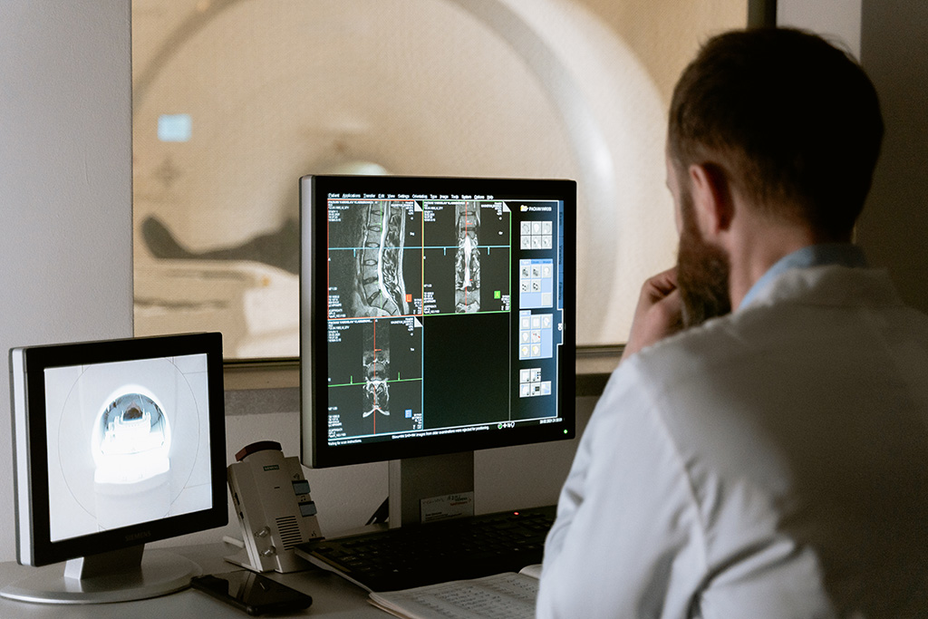 Imagen: La nueva tecnología de TC combinada con la reducción de ruido basada en IA mejora la detección del mieloma óseo (Fotografía cortesía de Pexels)