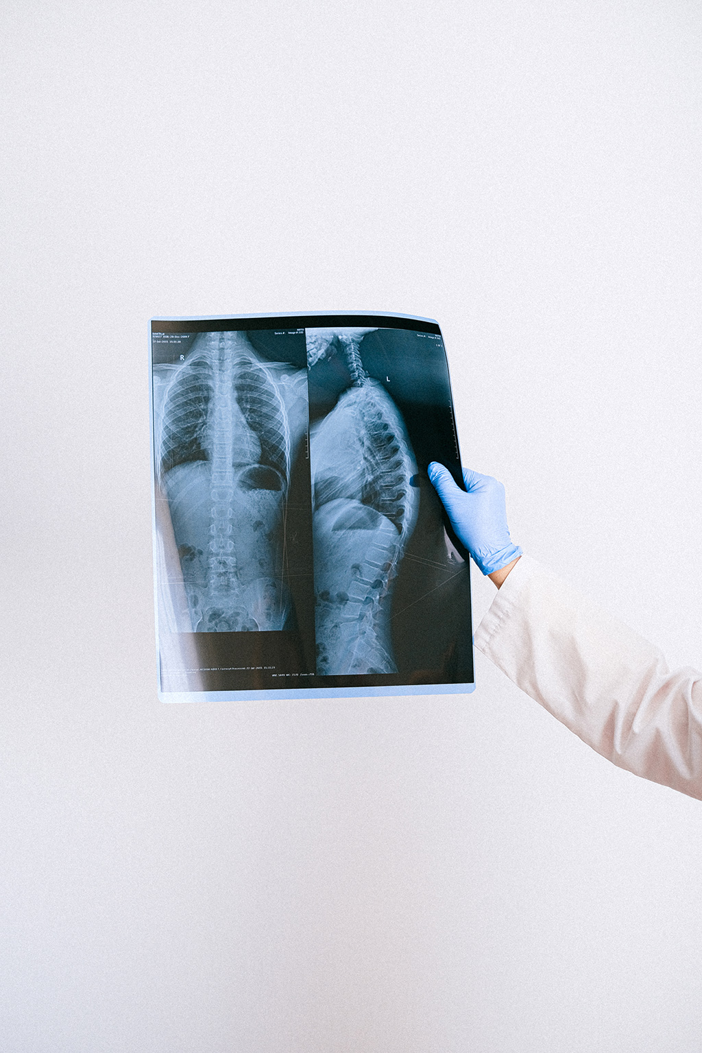 Imagen: Un sistema basado en IA se ha mostrado prometedor en la detección de tuberculosis (Fotografía cortesía de Pexels)