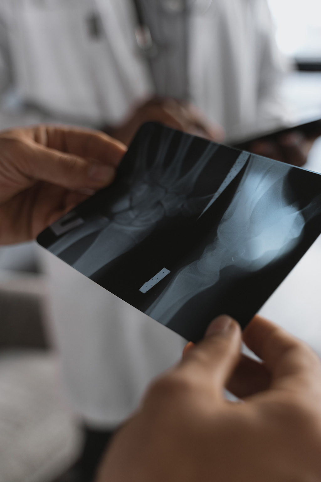 Imagen: El algoritmo de IA puede ayudar a evitar fracturas pasadas por alto en los exámenes de TC de cuerpo completo (Fotografía cortesía de Pexels)