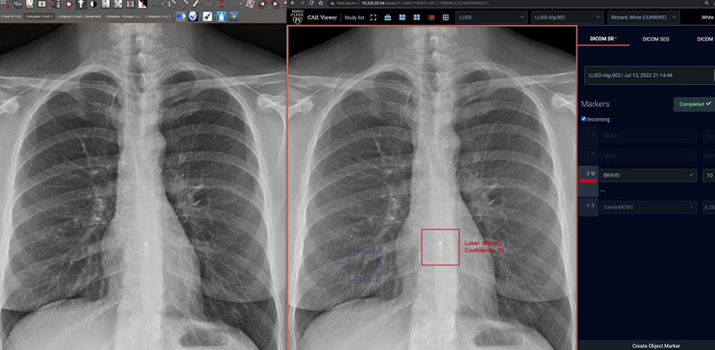 Imagen: El modelo de IA puede brindar resultados de inferencia a los radiólogos para la adjudicación antes del uso clínico (Fotografía cortesía de SPIE)