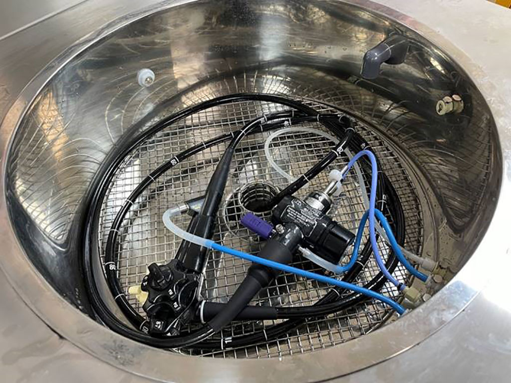 Imagen: El sistema de limpieza automatizado permite que los endoscopios se limpien directamente de la clínica (Fotografía cortesía de la Universidad de Aston)
