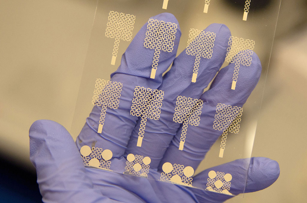 Imagen: Un conjunto de electrodos impresos serigrafía (Fotografía cortesía de la Universidad Estatal de Washington)