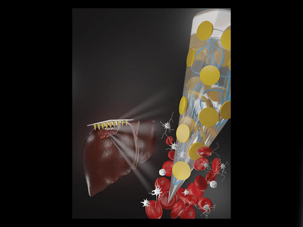 Imagen: La tecnología de microagujas hemostáticos se puede aplicar como un vendaje adhesivo típico para detener rápidamente el sangrado (Fotografía cortesía de Penn State)