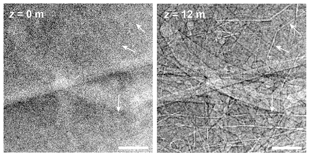 Imagen: La imagen compara los resultados simulados de la imagen de torax humano con radiografía ordinaria (izquierda) y con radiografía con contraste de fase (Fotografía cortesía de KTH)