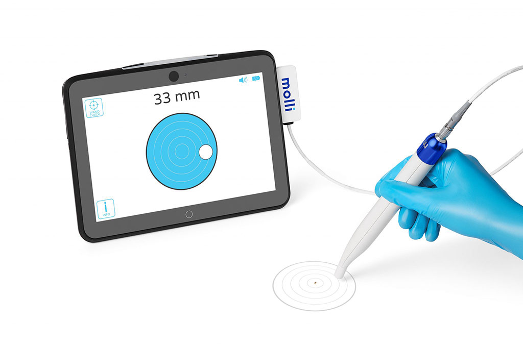 Imagen: MOLLI 2 y MOLLI re.markable están diseñados para refinar la cirugía de precisión (Fotografía cortesía de MOLLI)