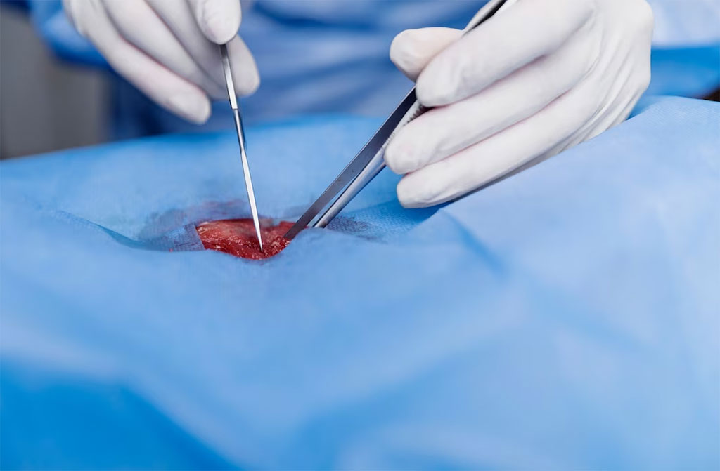 Imagen: Un nuevo procedimiento de biopsia de próstata transperineal con tecnología guiada por fusión puede detectar el cáncer de próstata (Fotografía cortesía de Freepik)