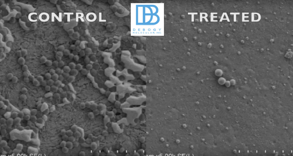 Imagen: La nueva tecnología mata a las bacterias peligrosas que proliferan en la superficie de los implantes médicos después de la cirugía (Fotografía cortesía de la DeBogy)