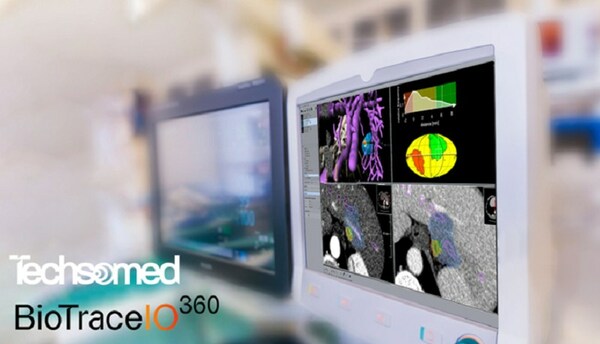 Imagen: La plataforma de terapia de ablación guiada por imágenes basada en IA BioTrace.IO (Fotografía cortesía de Techsomed)