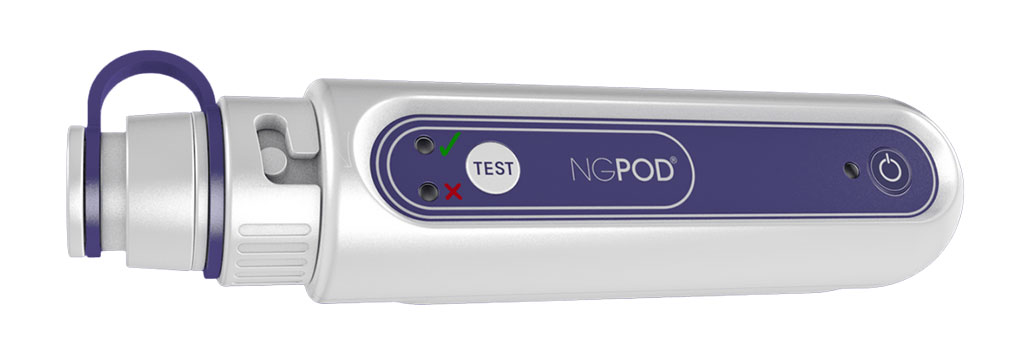 Imagen: El dispositivo NGPod está diseñado para la colocación correcta de las sondas nasogástricas (Fotografía cortesía de NGPod Global)