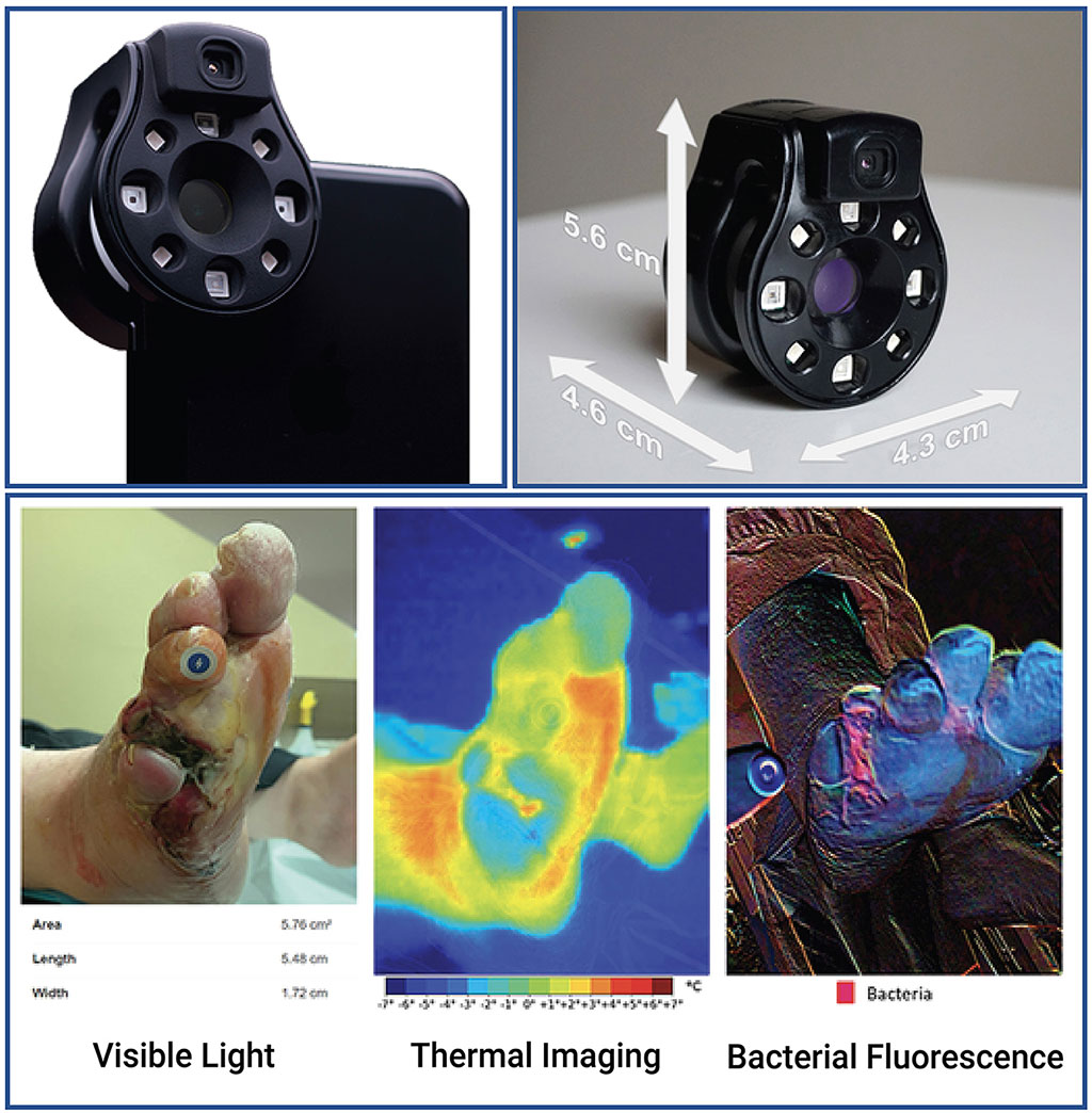 Imagen: El dispositivo de imagen hiperespectral Ray 1 (Fotografía cortesía de Frontiers in Medicine)