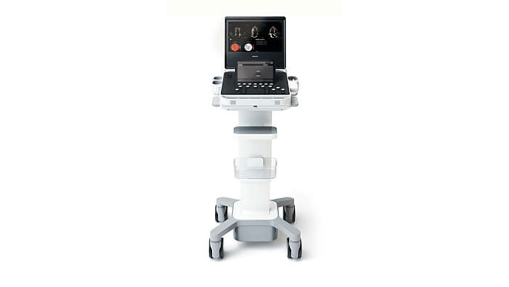 Imagen: El sistema de ultrasonido compacto de 5500CV ofrece funcionalidad completa y respuesta al primer escaneo (Fotografía cortesía de Royal Philips) Imagen: El sistema de ultrasonido compacto de 5500CV ofrece funcionalidad completa y respuesta al primer escaneo (Fotografía cortesía de Royal Philips)