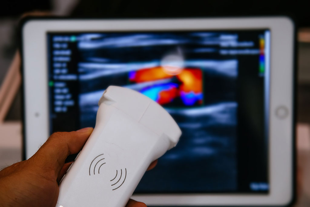 Imagen: Una nueva técnica de imágenes podría proporcionar imágenes más claras para los oncólogos (Fotografía cortesía de 123RF)