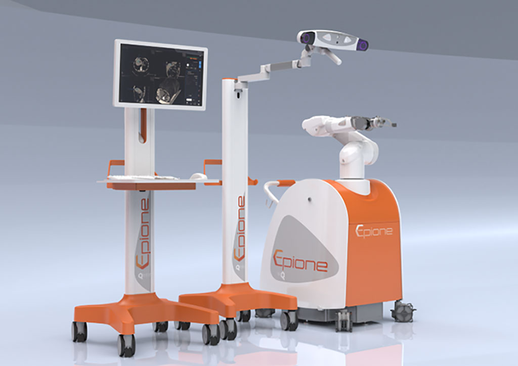 Imagen: La plataforma robótica de Epione obtuvo la aprobación de la marca CE para el uso ampliado en el tratamiento de tumores pulmonares (Fotografía cortesía de Quantum Surgical)