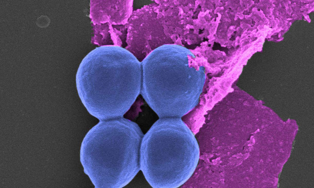 Imagen: Las formas de la bola son bacterias y la "hoja" es fósforo negro visto bajo un microscópio (Fotografía cortesía de la Universidad RMIT)