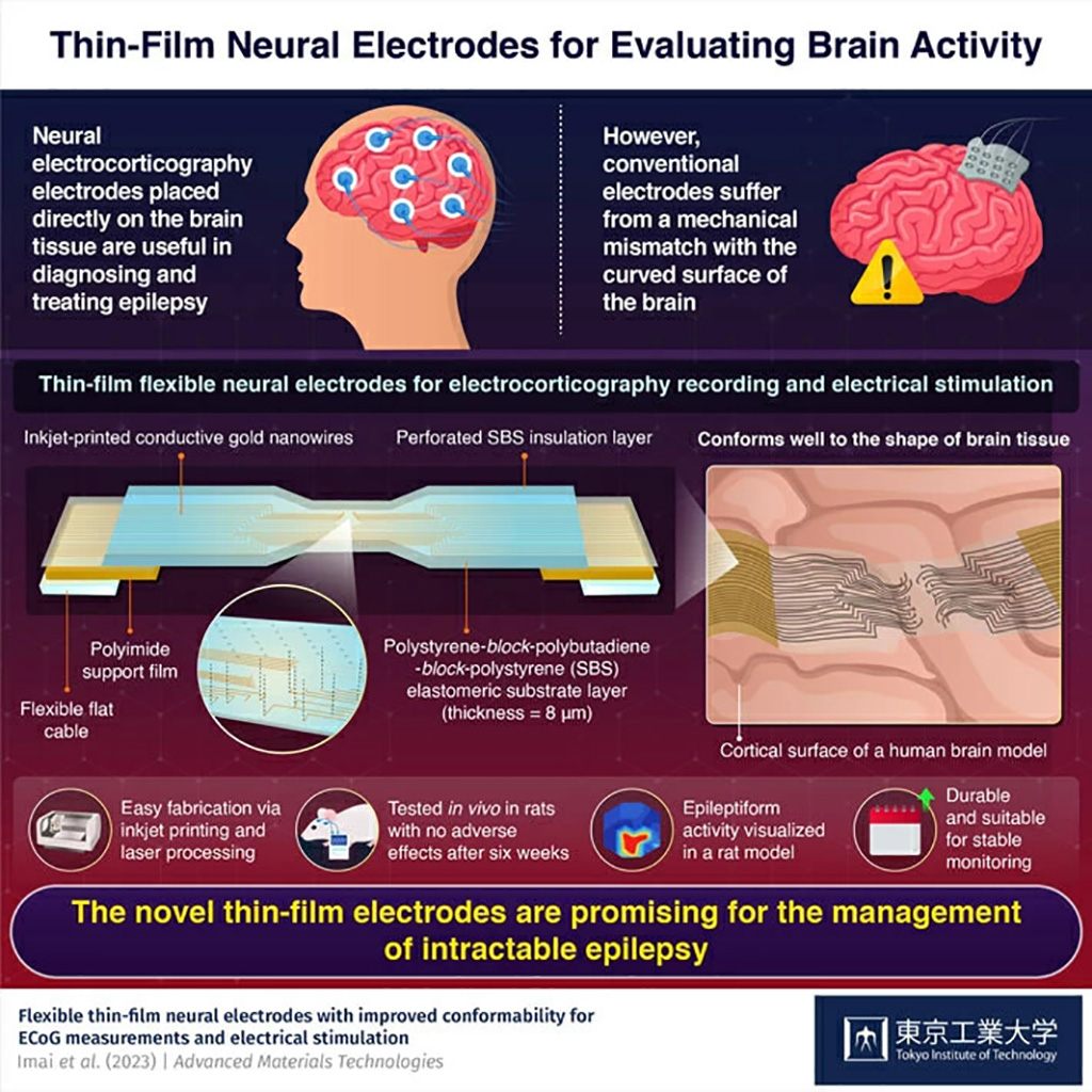 Imagen: Los electrodos de película delgada flexibles colocados directamente en el tejido cerebral han demostrado ser prometedores para el diagnóstico y el tratamiento de la epilepsia (Fotografía cortesía de Tokio Tech)