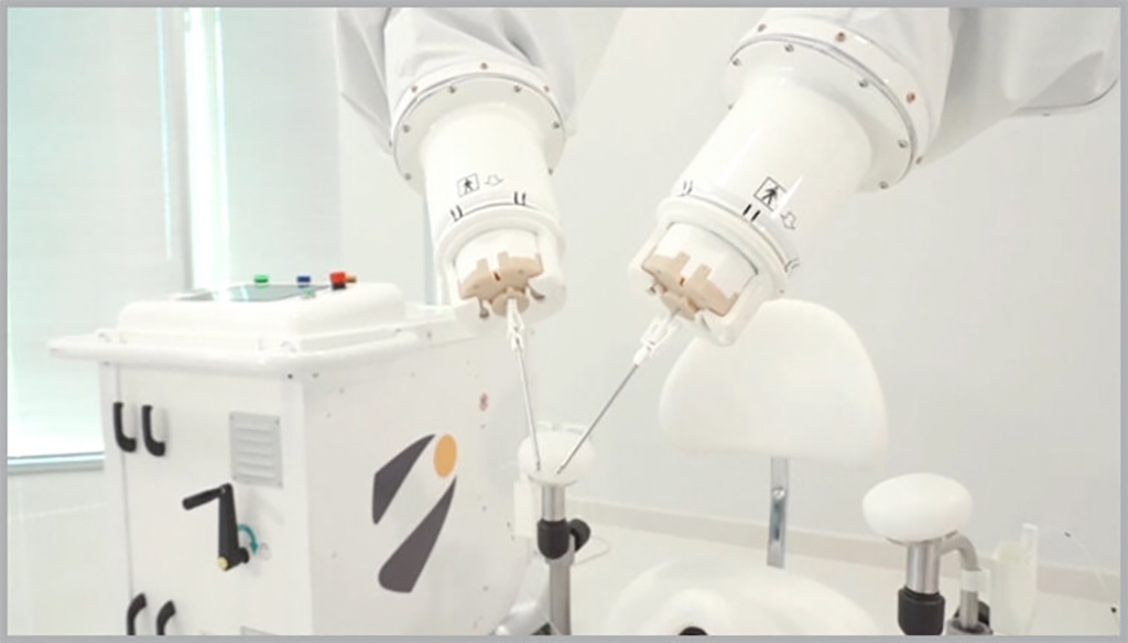 Imagen: El sistema quirúrgico de Symani es una plataforma flexible que consta de dos brazos robóticos (Fotografía cortesía de MMI)
