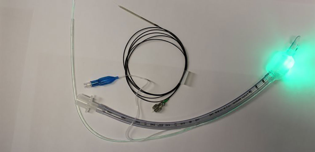 Imagen: El tubo endotraqueal inteligente iTraXS (Fotografía cortesía de la Universidad de Nottingham)