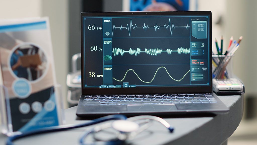 Imagen: El modelo de aprendizaje automático en tiempo real predice los paros cardíacos en el hospital utilizando la variabilidad de la frecuencia cardíaca en la UCI (Fotografía cortesía de 123RF)