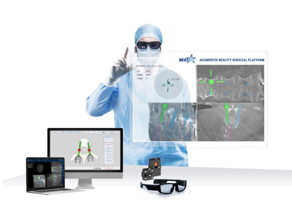 Imagen: El sistema de navegación asistido por RA NextAR puede ser factible y seguro en uso clínico (Fotografía cortesía de Medacta International)
