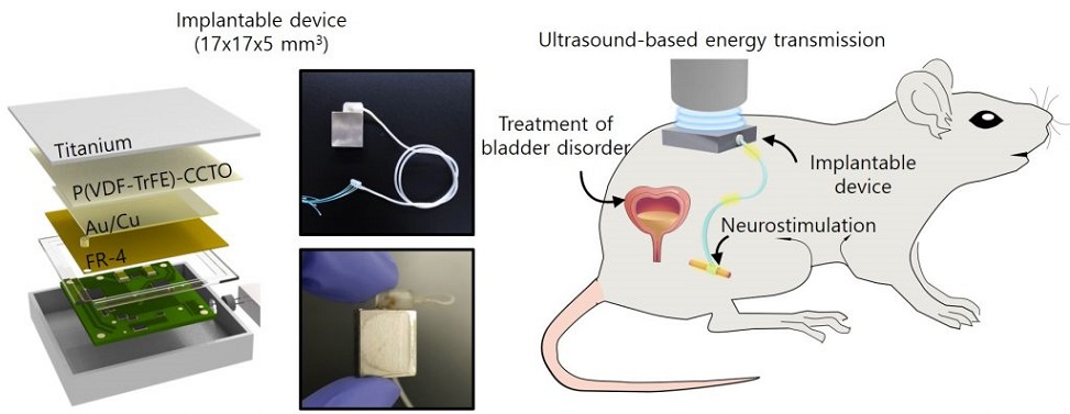 Imagen: Dispositivo médico implantable que utiliza materiales electrostáticos con altas propiedades dieléctricas para la transmisión de energía de ultrasonido (Fotografía cortesía de POSTECH)