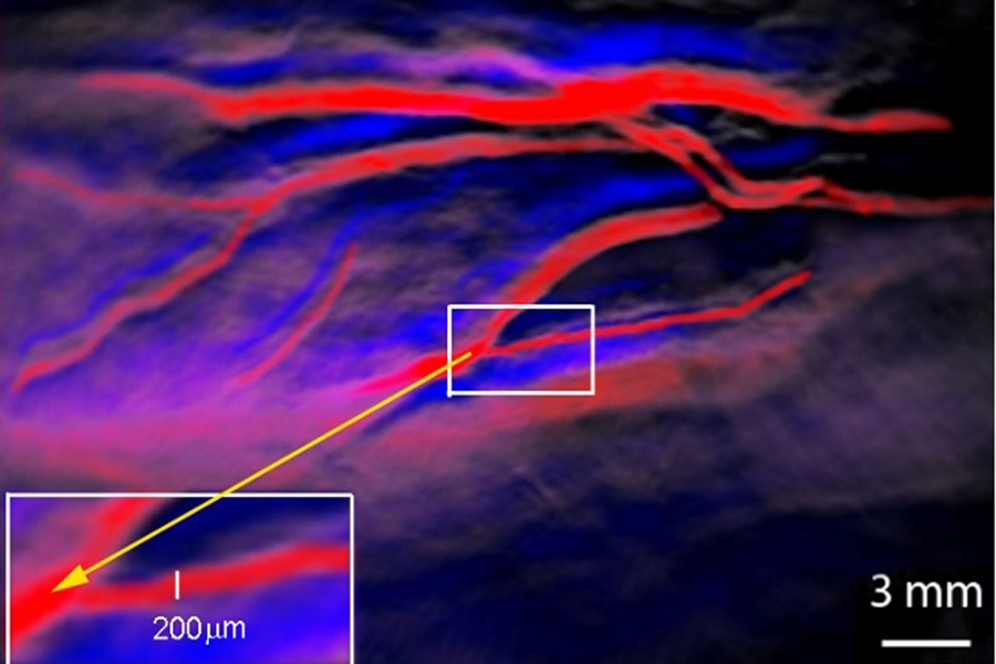 Imagen: La técnica puede distinguir las arterias (rojo) y las venas (azules) al nivel de 200 micrones (Fotografía cortesía de la Universidad de Oklahoma)