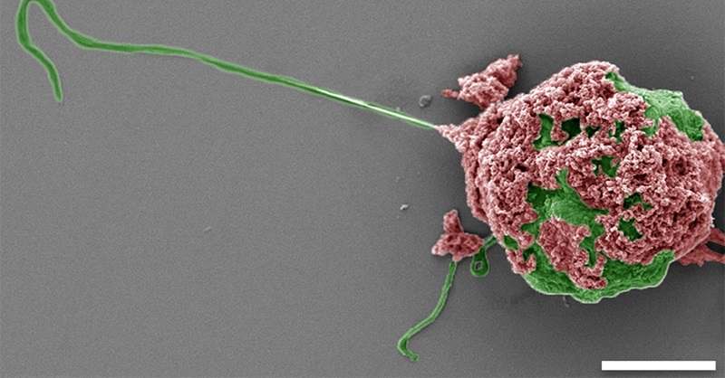 Imagen SEM  en color de un microrobot hecho de una célula de alga (verde) cubierta con nanopartículas que imitan macrófagos (rojo) (foto cortesía de Li et al, Science Robotics)