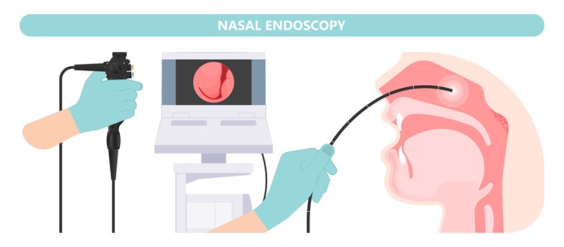 Imagen: La aplicación de redes neuronales convolucionales puede mejorar la precisión y eficiencia de la endoscopia nasal (foto cortesía de Shutterstock)