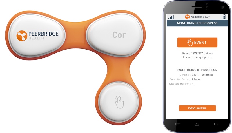 Imagen:  Peerbridge Cor es un AECG inalámbrico de 3 derivaciones y 2 canales que simplifica el proceso de diagnóstico (foto cortesía de Peerbridge Health)