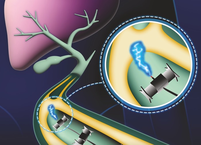 Imagen: Los investigadores realizaron un procedimiento quirúrgico eléctrico en una obstrucción del conducto biliar de forma experimental con un convoy robótico (foto cortesía de DKFZ)