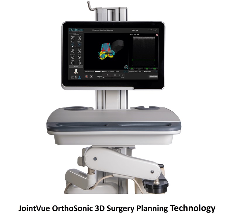 Imagen: La tecnología de planificación quirúrgica 3D JointVue OrthoSonic (foto cortesía de JointVue)