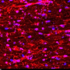 Imagen: tinción representativa de células endoteliales arteriales (PECAM1-rojo) y núcleos celulares (DAPI-azul) (Foto cortesía de John Maufort)