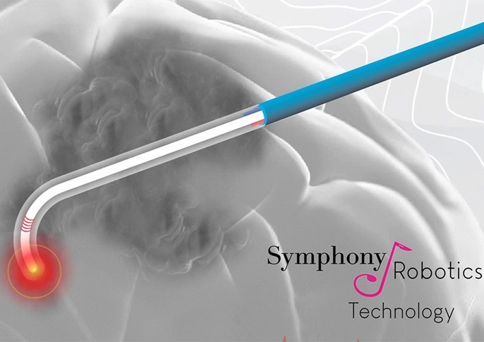 Imagen: La plataforma microrrobótica flexible, no lineal y sin motor aprovecha la IA para optimizar el tratamiento del glioblastoma (foto cortesía de Symphony Robotics) Imagen: La plataforma microrrobótica flexible, no lineal y sin motor aprovecha la IA para optimizar el tratamiento del glioblastoma (foto cortesía de Symphony Robotics)