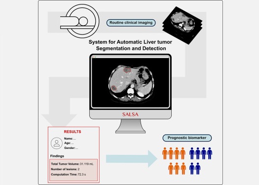 Imagen: SALSA es una nueva herramienta de IA para el análisis automatizado y preciso de tumores hepáticos (foto cortesía de VHIO) Imagen: SALSA es una nueva herramienta de IA para el análisis automatizado y preciso de tumores hepáticos (foto cortesía de VHIO)