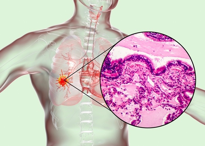Imagen: el nuevo método basado en IA puede predecir los resultados del tratamiento a partir de datos de registros de salud (foto de 123RF) Imagen: el nuevo método basado en IA puede predecir los resultados del tratamiento a partir de datos de registros de salud (foto de 123RF)