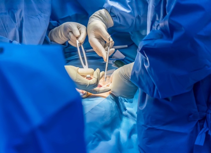 Imagen: se ha descubierto que un nuevo método quirúrgico es eficaz tanto para las hernias inguinales como para las femorales (foto cortesía de Adobe Stock) Imagen: se ha descubierto que un nuevo método quirúrgico es eficaz tanto para las hernias inguinales como para las femorales (foto cortesía de Adobe Stock)