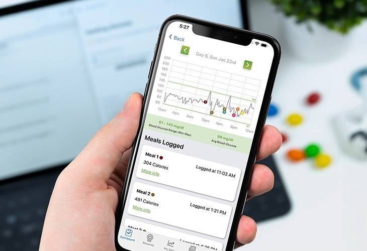 Imagen: los sensores portátiles y la IA podrían transformar la detección y el manejo de la prediabetes (foto cortesía de Scripps Research) Imagen: los sensores portátiles y la IA podrían transformar la detección y el manejo de la prediabetes (foto cortesía de Scripps Research)