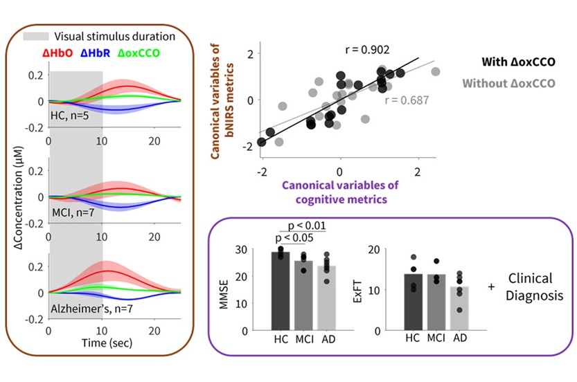 Imagen: la técnica portátil puede ser eficaz para diagnosticar y controlar la demencia (foto cortesía de D. Acharya et al./University of Cambridge) Imagen: la técnica portátil puede ser eficaz para diagnosticar y controlar la demencia (foto cortesía de D. Acharya et al./University of Cambridge)