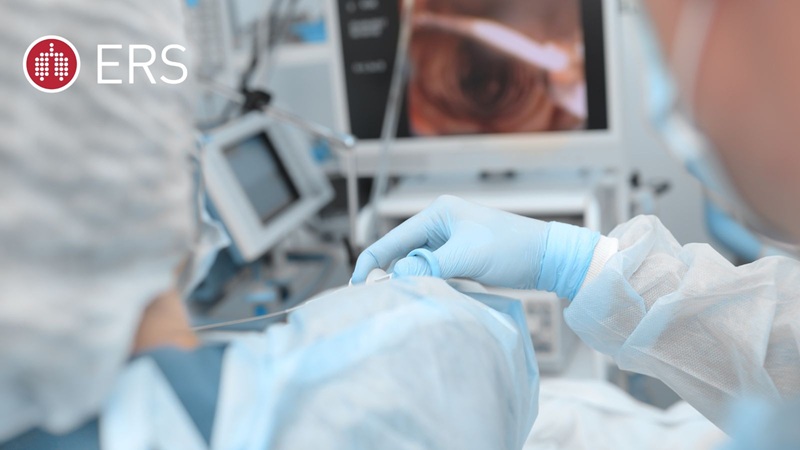 Imagen: el broncoscopio asistido por robot utiliza un escáner de TC especializado para encontrar tumores enterrados en los pulmones (foto cortesía del Hospital Universitario Zürich) Imagen: el broncoscopio asistido por robot utiliza un escáner de TC especializado para encontrar tumores enterrados en los pulmones (foto cortesía del Hospital Universitario Zürich)