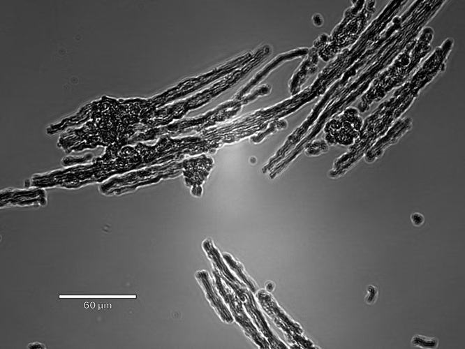 Imagen: Un andamio mesoporoso basado en varillas de sílice que se autoensambló después de la inyección (Foto cortesía del Instituto Wyss de la Universidad de Harvard)