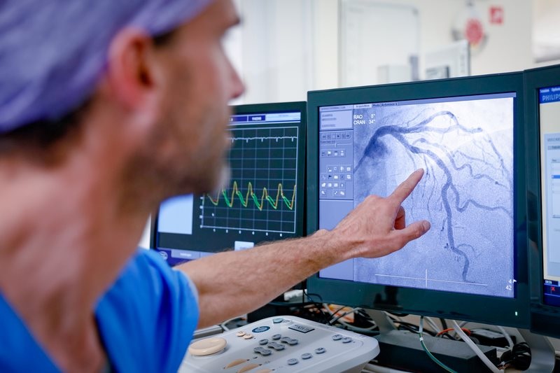 Imagen: las arterias no responsables del infarto pueden tratarse semanas después del ataque cardíaco sin que ello aumente el riesgo (Foto cortesía de Radboud UMC) Imagen: las arterias no responsables del infarto pueden tratarse semanas después del ataque cardíaco sin que ello aumente el riesgo (Foto cortesía de Radboud UMC)