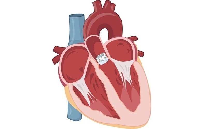 Imagen: Tres nuevos ensayos de válvulas han validado mejores formas de reparar un corazón que funciona mal (Fotografía cortesía de Shutterstock)