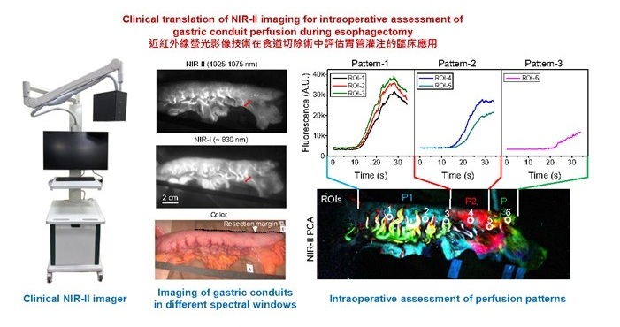 Imagen: las imágenes de fluorescencia infrarroja ayudan a los cirujanos a ver la perfusión sanguínea durante la cirugía esofágica (Foto cortesía de Wang et al, PNAS 2025)