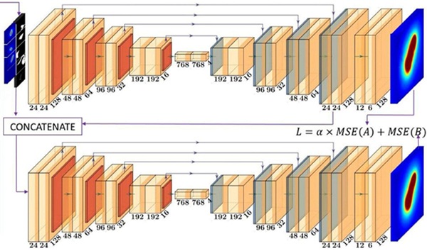 Imagen: el modelo de inteligencia artificial de dos etapas llamado cascade U-Net predice la dosis de radiación para un plan de braquiterapia (Fotografía cortesía de Lance Moore/UC San Diego) Imagen: el modelo de inteligencia artificial de dos etapas llamado cascade U-Net predice la dosis de radiación para un plan de braquiterapia (Fotografía cortesía de Lance Moore/UC San Diego)